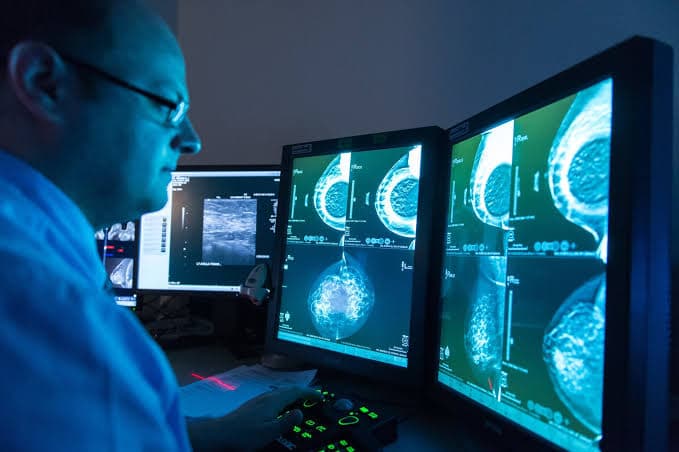 Clinician reviewing mammography scans on several monitors
